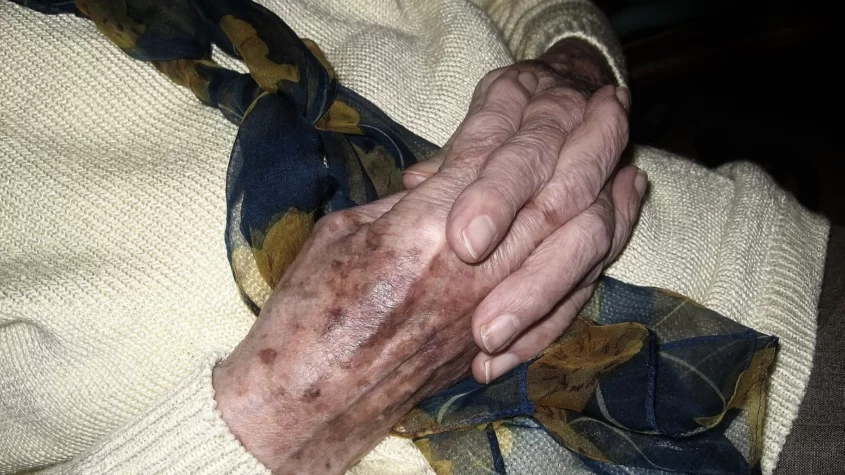 hands_woman_old_age_age_spots_pray_fold_folded_relaxation