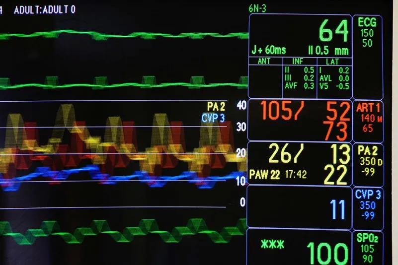 « La mort par don d’organes » gagne du terrain dans de prestigieuses revues médicales
