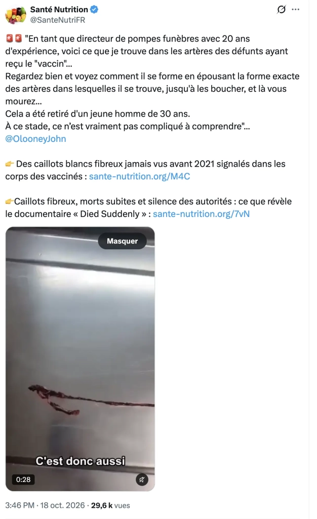 Caillots fibreux, morts subites et silence des autorités : ce que révèle le documentaire « Died Suddenly »